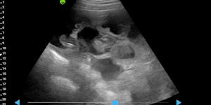 Porcine embryo